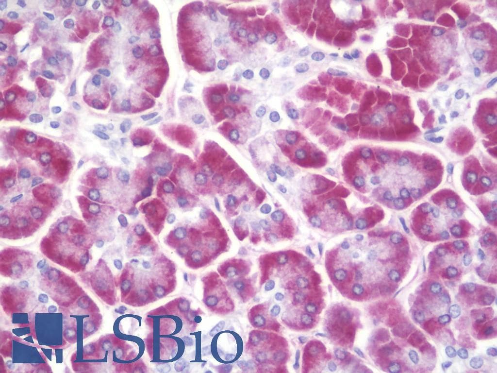 IHC-plus™ Polyclonal Rabbit anti-Human SMPD1 / Acid Sphingomyelinase Antibody (aa391-419, IHC, WB)