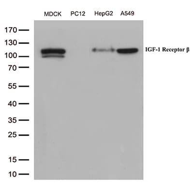 IGF1R / IGF1 Receptor Antibody (aa741-935, clone OTI4C4)