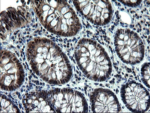 ZFAND3 / TEX27 Antibody (clone OTI1E9)