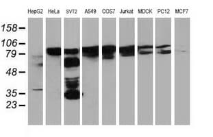 BCAR1 / p130Cas Antibody (clone OTI1A9)