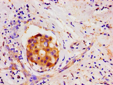 LIN28A / LIN28 Antibody