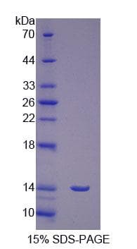 Human FSH Receptor / FSHR Protein (Recombinant His)