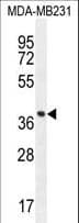 FOXA2 Antibody (aa128-157)