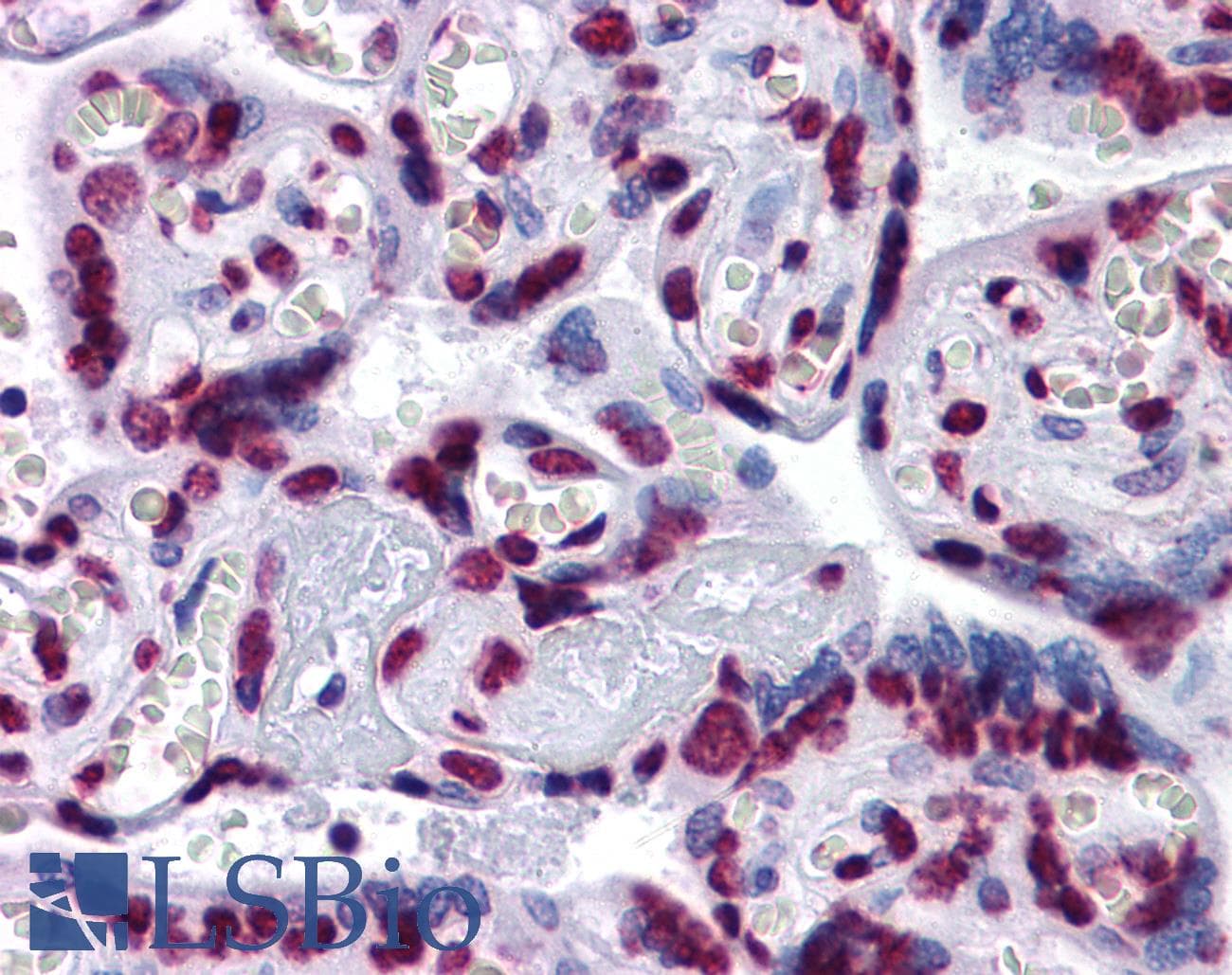 IHC-plus™ STAT3 Antibody (clone 7G3H4)