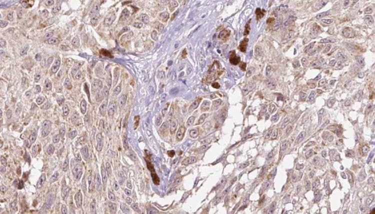 Polyclonal Rabbit anti-Human CGREF1 Antibody (IHC, IF, WB)