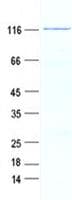 Human GTSE1 Protein (Recombinant GST, N-terminus + His, C-terminus)