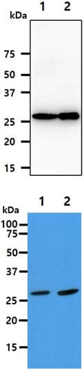 AK2 / Adenylate Kinase 2 Antibody (clone AT7E7)