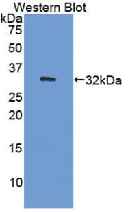 DNMT / DNMT1 Antibody (aa1343-1570)