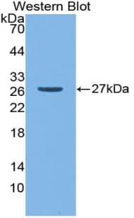 Polyclonal Rabbit anti-Human MMP2 Antibody (Biotin, aa110-660, WB)