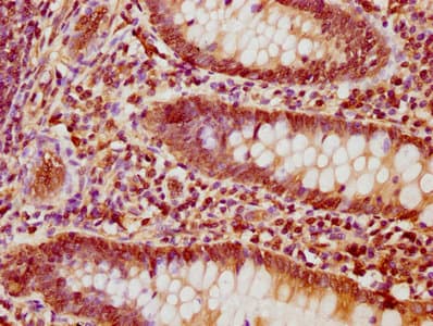 Polyclonal Rabbit anti-Human NFATC1 / NFAT2 Antibody (IHC, IF)