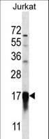 PFDN5 / MM1 Antibody (aa79-108)