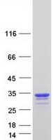 Human CREG / CREG1 Protein (Recombinant Myc-DDK (Flag))