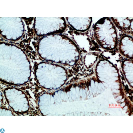 Polyclonal Rabbit anti-Human HSPA5 / GRP78 / BiP Antibody (WB)