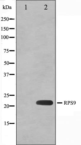 Polyclonal Rabbit anti-Human RPS9 / Ribosomal Protein S9 Antibody (IF, WB)