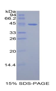 Human GHRH Protein (Recombinant His-GST)
