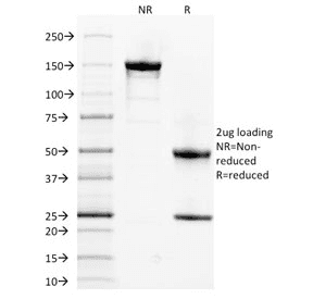 SPTA1 / Alpha Spectrin Antibody (clone SPTA1/1832)