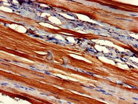 Polyclonal Rabbit anti-Human FMOD / Fibromodulin Antibody (IHC, WB)