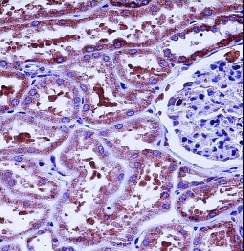 HTRA2 / OMI Antibody (aa73-102)