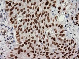 PRKCE / PKC-Epsilon Antibody (clone OTI4G8)