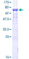 Human TUBB / Beta Tubulin Protein (Recombinant GST)