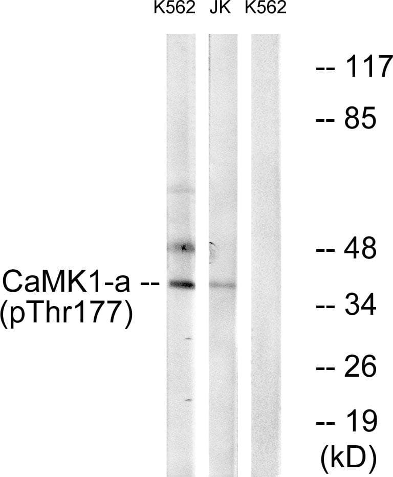CAMK1 / CAMKI Antibody (phospho-Thr177)