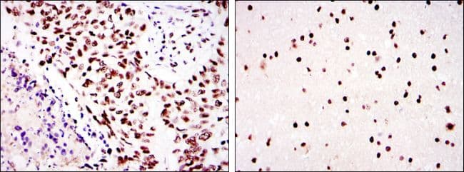 PRKDC / DNA-PKcs Antibody (clone 3H6)