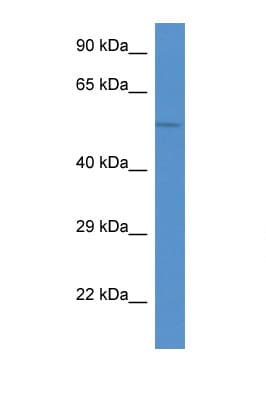Antithrombin-III Antibody (C-Terminus)