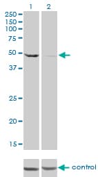DDX6 Antibody (clone 3D2)