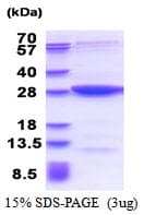 Human MOBKL2B / MOB3B Protein (Recombinant His)