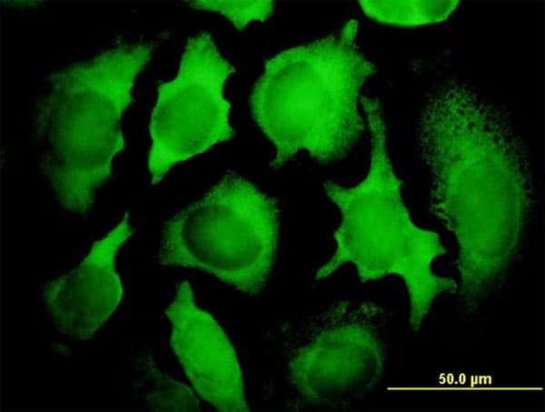PCNA-Associated Factor Antibody (clone 3C11-1F11)