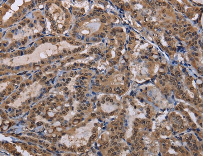 Polyclonal Rabbit anti-Human CUL3 / Cullin 3 Antibody (IHC, WB)