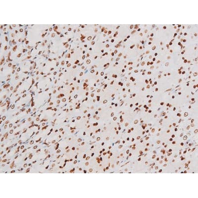 Polyclonal Rabbit anti-Human RELA / NFKB p65 Antibody (phospho-Thr435, IHC, IF, WB)