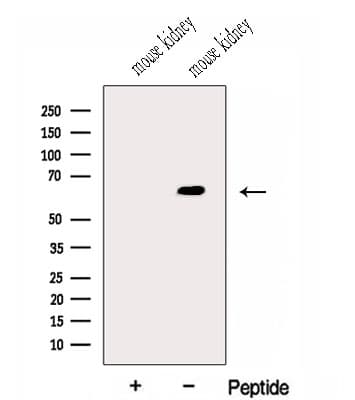 GALNT14 Antibody