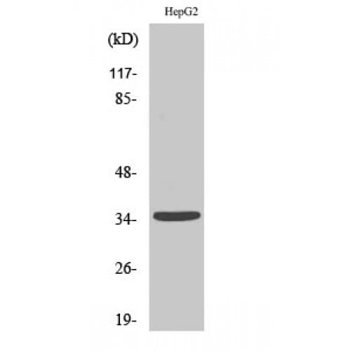 UBR1 Antibody (790-870 aa, Internal)