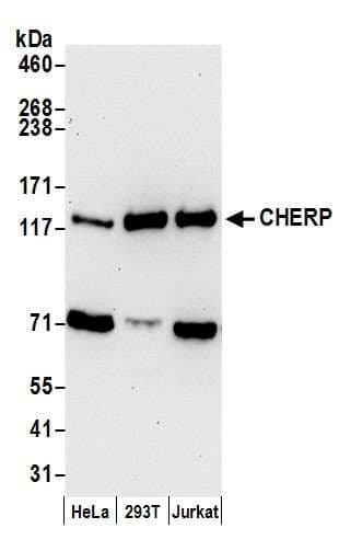 CHERP Antibody (aa866-916)