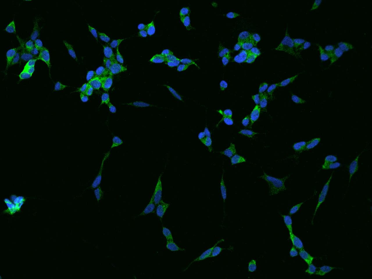 Polyclonal Rabbit anti-Human GPRASP1 / GASP-1 Antibody (IHC, IF)