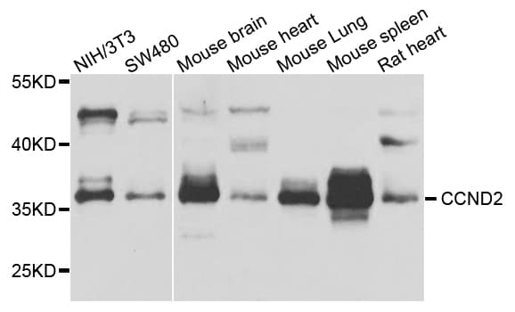 IHC-plus™ CCND2 / Cyclin D2 Antibody