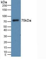 Human HRG Protein (Recombinant His, N-Terminal)
