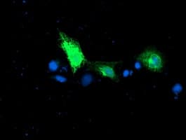 Monoclonal Mouse anti-Human RPN1 / Ribophorin I Antibody (clone OTI1G5, IF, WB)