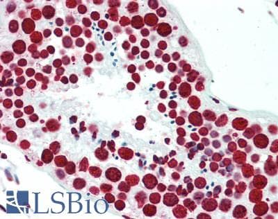 IHC-plus™ HIST1H3H Antibody