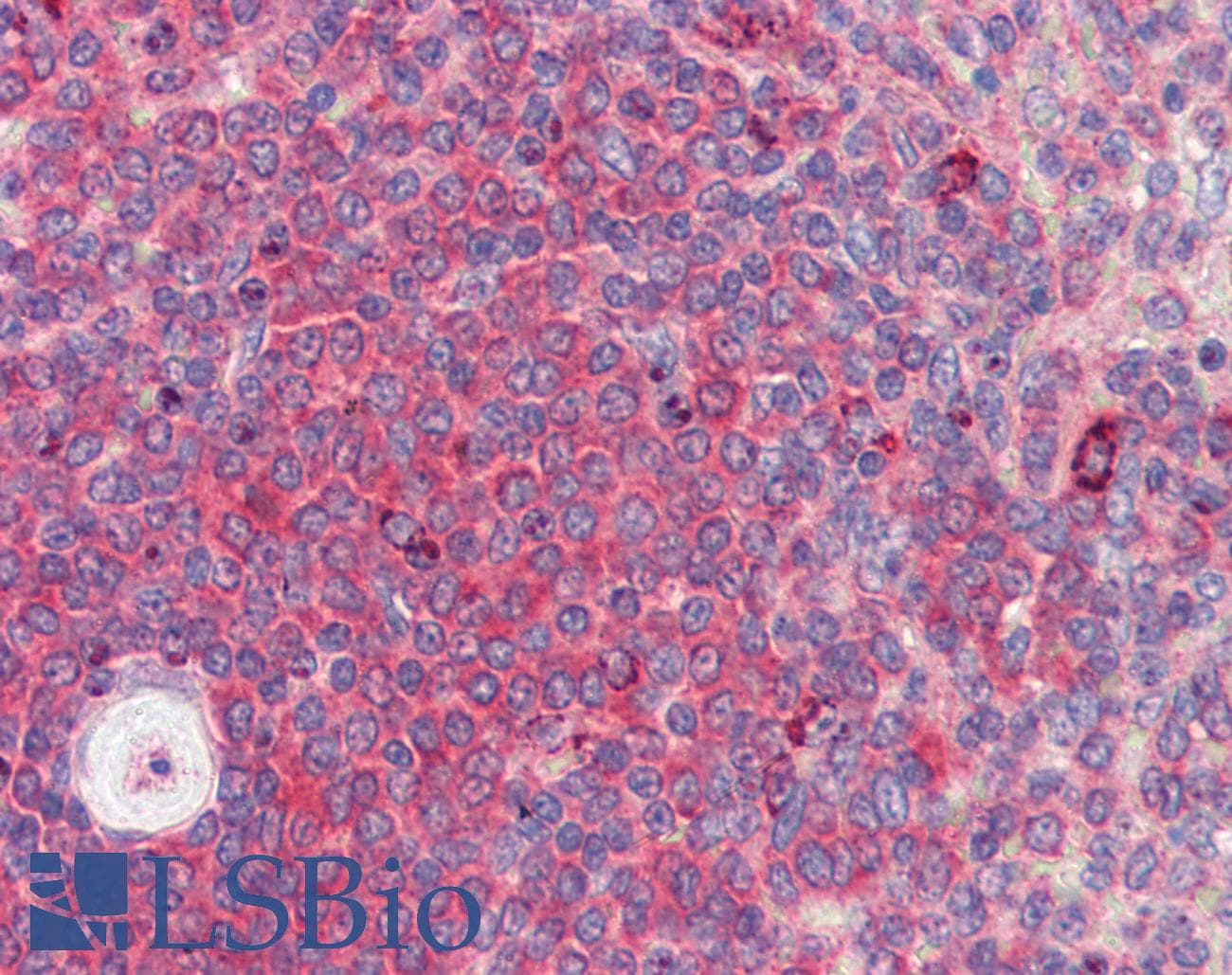 Polyclonal Rabbit anti-Human BACH2 Antibody (C-Terminus, IHC, WB)