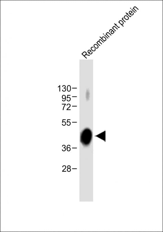 ADAMTS4 Antibody (clone 1995CT113.89.78)