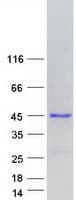 Human ENDOU Protein (Recombinant Myc-DDK (Flag))