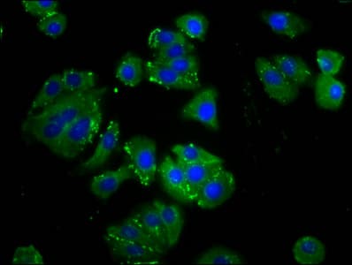 Polyclonal Rabbit anti-Human C1orf27 Antibody (IHC, IF, WB)
