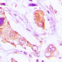 TAOK1 / TAO1 Antibody (Internal)