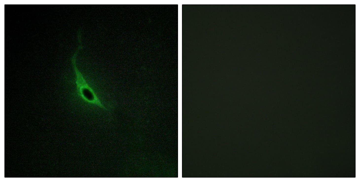 Polyclonal Rabbit anti-Human ARHGEF17 / TEM4 Antibody (IHC, IF)