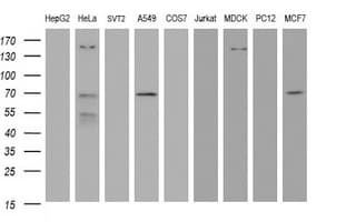 Monoclonal Mouse anti-Human METTL16 / METT10D Antibody (clone OTI3E8, IHC, WB)