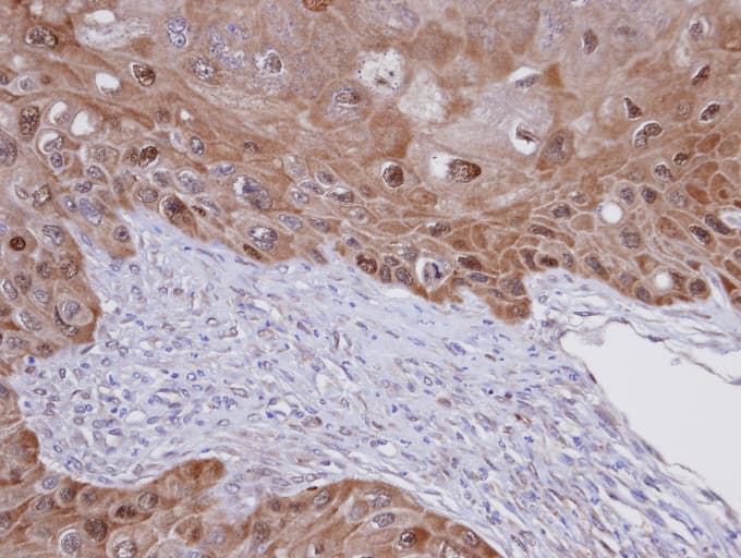 IDI1 / IPP1 Antibody (aa1-173)
