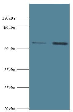 IL1R1 Antibody (aa18-320)