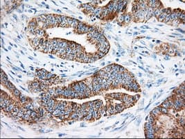 KHK / Ketohexokinase Antibody (clone OTI1D8)